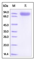 Mouse ROR1, Fc Tag on SDS-PAGE under reducing (R) condition. The gel was stained overnight with Coomassie Blue. The purity of the protein is greater than 95%.